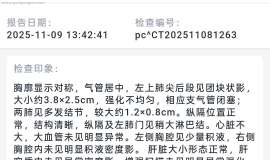 求助母肺腺癌晚期治疗方案咨询