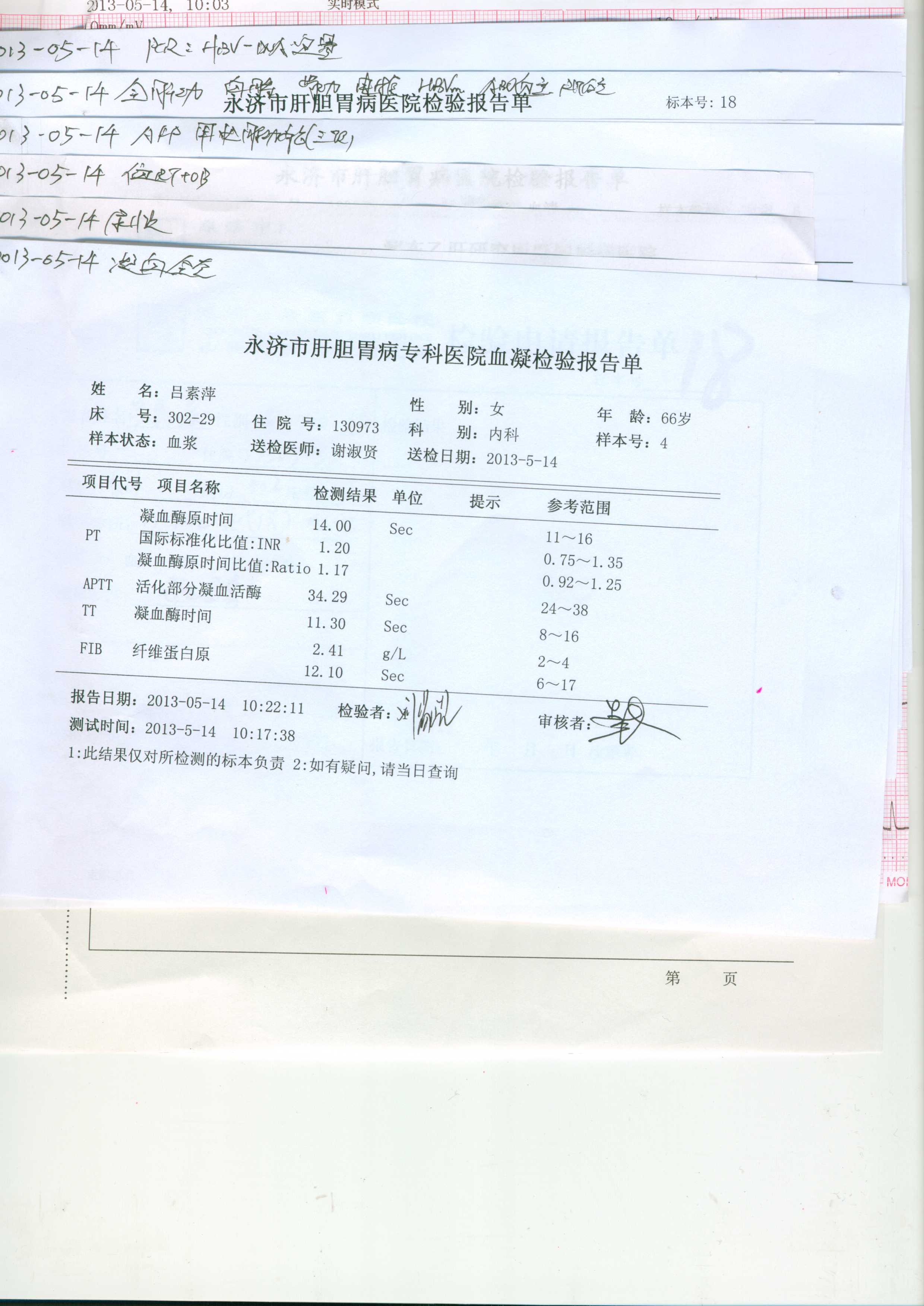 血凝检验报告